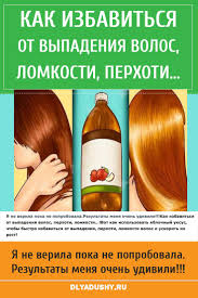 как избавиться от перхоти в домашних условиях быстро и эффективно Kak Izbavitsya Ot Vypadeniya Volos Perhoti Lomkosti Volosy Perhot Vypadenie Volos