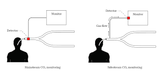 Image result for Colorimetric Capnometry