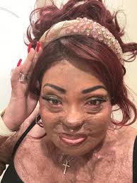 Congratulations man. You can do it!!