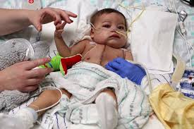 Baby Lincoln Was In His Last Days Then A New Heart Arrived Heart Transplant New Heart Baby