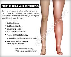 Warning Signs Of Deep Vein Thrombosis How Do I Know If I Have Dvt