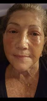 Ben J Childers, MD, 4605 Brockton Ave, Ste 200, Riverside, CA 92506, US