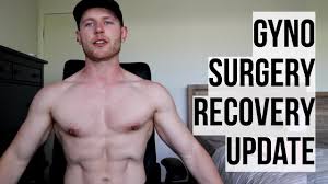 4 Months Post Gynecomastia Surgery Recovery Update Youtube