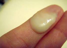 What does bv look like pictures. Early Pregnancy Mucus Plug Shefalitayal