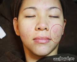 The side of the body where the hand holds and pilots the rod. Blemish Fionaseah Com