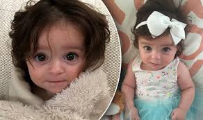 Get diet and wellness tips to help your kids stay healthy and happy. Baby Girl Born With Hairy Forehead Back And Bottom Shocks Parents Express Co Uk