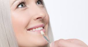 What Do Teeth Look Like Under Veneers?