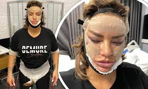 Vale aclarar, para quienes me ven como una extranjera, que crecí desde muy niña en una finca en el tolima. Katie Price Looks Unrecognisable In Horrific Post Surgery Snaps In Turkey Daily Mail Online