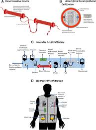 Typical symptoms of a lean mixture are: A Critical Review Of Current Progress In 3d Kidney Biomanufacturing Advances Challenges And Recommendations Renal Replacement Therapy Full Text
