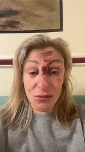 Just had a break up with my. Wife I really need a drink I been 17 months  sober