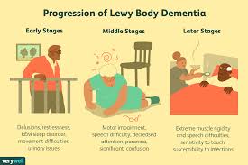 Cognitive decline of sufficient magnitude to interfere with. Stages And Progression Of Lewy Body Dementia