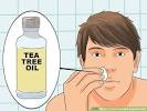 How To Treat An Ingrown Hair Cyst