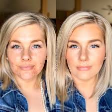 Dealing with criticism based