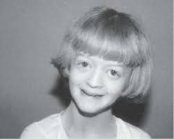 Syndromes of Orthopaedic Importance