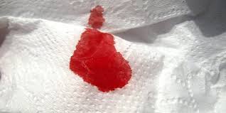 Sap tanda tanda bahaya kehamilan. 14 Penyebab Menstruasi Tidak Lancar Salah Satunya Karena Sindrom Pcos Merdeka Com