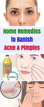This Mask Will Banish Your Acne Home Remedies For Acne Natural Acne Remedies Acne And Pimples