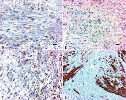There really is a lot to remember, so consider taking one of our muscle quizzes covering the different muscles of the body to improve your confidence (more on these below). Uterus Cat Immunohistochemistry Shows Positive Reaction For A Smooth Download Scientific Diagram