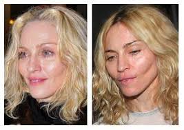 Erik hoy ­long before anyone thought to nip and tuck or even heard of. Plastic Surgery Madonna Plastic Surgery She Is Now In Facebook