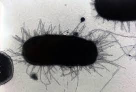 Coli (stec) after the toxin that they produce. E Coli Superbug Strains Can Persist In Healthy Women S Guts Newsroom