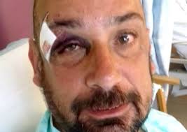 Football fan was feared dead after savage attack