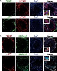 Qiu yao mei leng guo chuan chuan (cheng dou). Setdb1 Plays An Essential Role In Maintenance Of Gonocyte Survival In Pigs In Reproduction Volume 154 Issue 1 2017