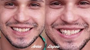 Bicarbonato De Sodio Sera Que Deixa Os Dentes Mais Brancos Marco Da Moda Moda Blog De Moda Masculina Bicarbonato De Sodio
