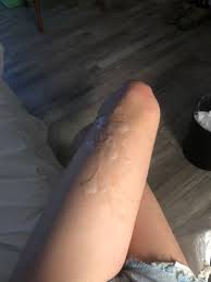 射在腿上- Twitter Hashtag | Sotwe