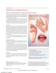 Mild fever hfmd is sometimes confused with foot and mouth disease (also called hoof and mouth disease), which is a viral infection that exclusively affects farm. Pdf Hand Foot And Mouth Disease