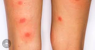 Pin On Home Remedies