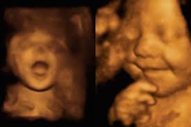 Ketahui 10 klinik dan doktor obstetrik dan ginekologi (pakar wanita) terbaik di malaysia, taraf 4.6/5 dari 485 ulasan oleh rangkaian sokongan kesihatan masyarakat kami. 3d 4d Scan Ini Senarai Klinik Hospital Di Malaysia