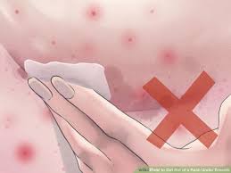 Pin On Health