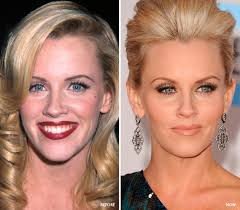 Hollywood S Best Botox Newbeauty Botox Fillers Facial Fillers Botox