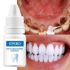 A dentist can clean your teeth in a. Teeth Whitening Gel Serum Removes Plaque Stains Deep Teeth Cleaning Whitening Essence Oral Hygiene Remove Stains Dental Tool Teeth Whitening Aliexpress