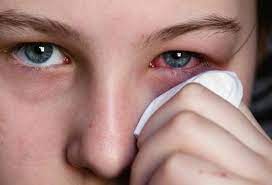 Mata mak tercucuk kayu, menangis saya tengok mata mak. Konjunktivitis Punca Penolong Pegawai Perubatan Facebook