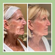 Laser SkinCare of Louisiana