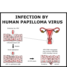 Image result for human papillomavirus symptoms