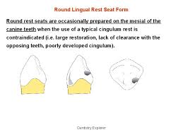 We did not find results for: Mesial Definition Example