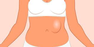 We did not find results for: What Is A Hernia How To Tell If You Have A Hernia
