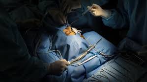 La mucormicosis es una infección fúngica, no suele ser muy habitual. Por Que El Hongo Negro Afecta A Los Pacientes De Covid 19