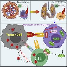 Tumor PD-L1 engages myeloid PD-1 to suppress type I interferon to impair  cytotoxic T lymphocyte recruitment: Cancer Cell