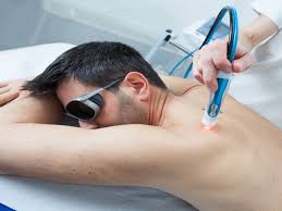 Image result for Electrical Stimulation Therapy