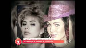 A lady la vemos en las noches en pantalla chica en la novela pasión de gavilanes , novela que se ha tomado el rating aunque fue transmitida por primera vez hace 17 años. 6 Famosas Que Vivieron Un Infierno Tras Inyectarse Biopolimeros El Universal Cartagena