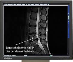We did not find results for: Mrt Wirbelsaule Die Ursachen Fur Ruckenschmerzen Finden
