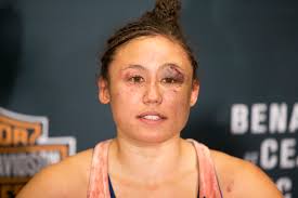 Las Vegas' Jamie Moyle defeats Kailin Curran in bloody UFC debut