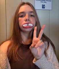 Hello Golpa Family. Today is day 10 with my new smile...Everything is still  progressing so well and I am in awe of Dr. Fadi, Dr. Golpa and the Entire  Tysons Corner staff.