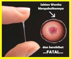 Keputihan bercampur darah dapat dikatakan tidak normal jika keputihan tersebut berbau tidak sedap, disertai dengan rasa gatal dan tidak lagi bewarna jernih / keruh. Herbal Wanita Indonesia Waspadai Keputihan Keputihan Adalah Cermin Kesehatan Perempuan Keputihan Yang Normal Tidak Berbau Mengandung Sedikit Asam Bentuknya Sedikit Kental Seperti Putih Telur Yang Setengah Transparan Jumlahnya Ada Kaitan Erat