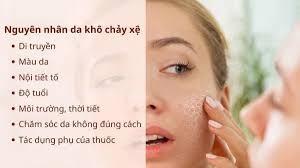 Chứng da khô xử lý thế nào cho hiệu quả?