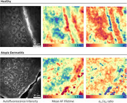 Authors ron c li 1 2 , steven m asch 3 4 , nigam h shah 2 affiliations 1 division of hospital medicine, department of. Artificial Intelligence In Multiphoton Tomography Atopic Dermatitis Diagnosis Scientific Reports