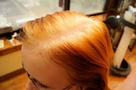 Whether there was miscommunication with your stylist or you gave yourself a bad dye job at home, there are easy ways to fix the problem, so don't. Editing Is Like Trying To Fix A Bad Hair Dye Job Angela M Caldwell