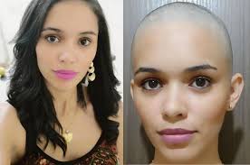 Every woman should have a shaved head at least once in her life, and here's a few reasons to do it. Pin On Before And After